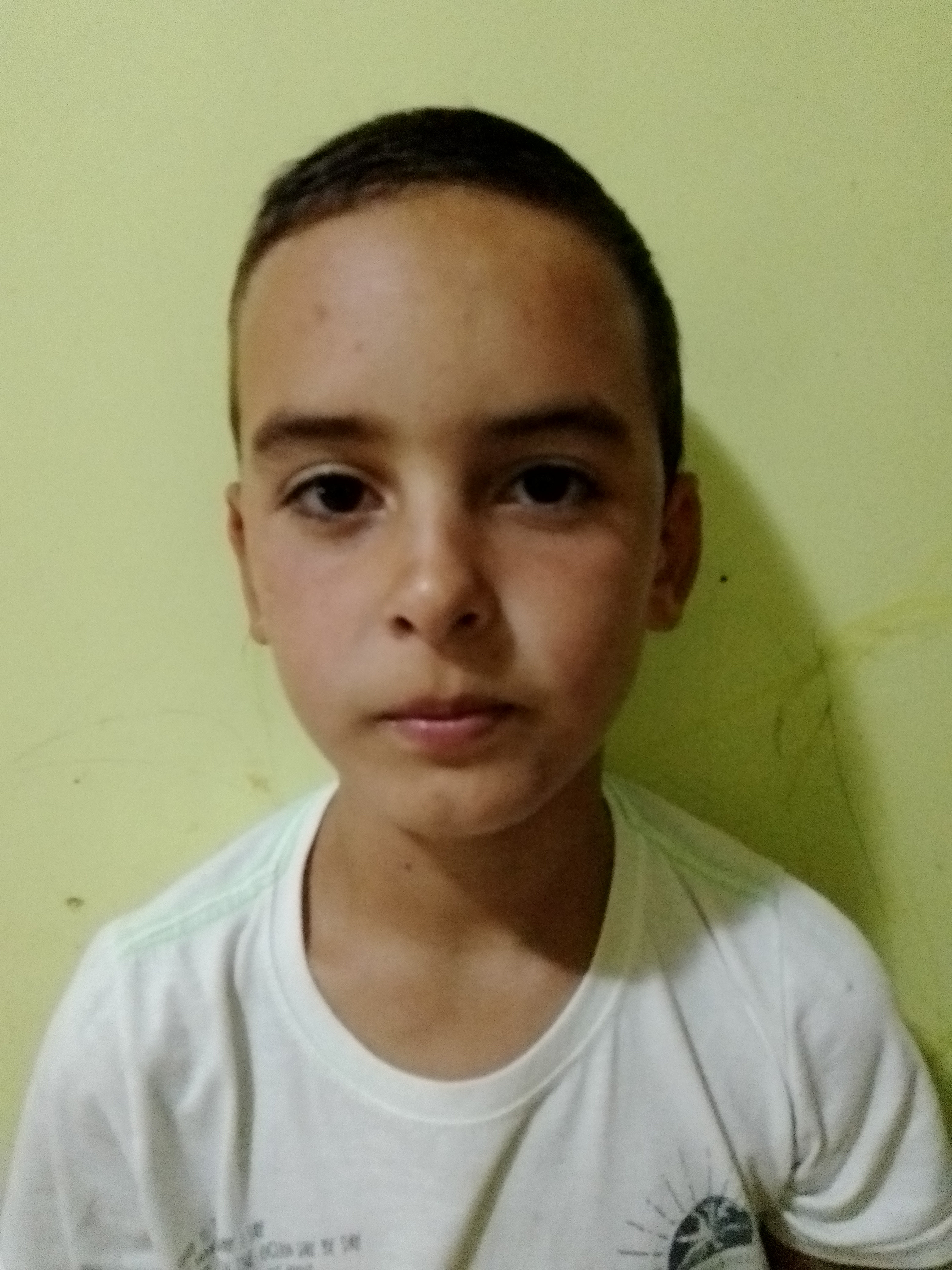 Bola pra Cima